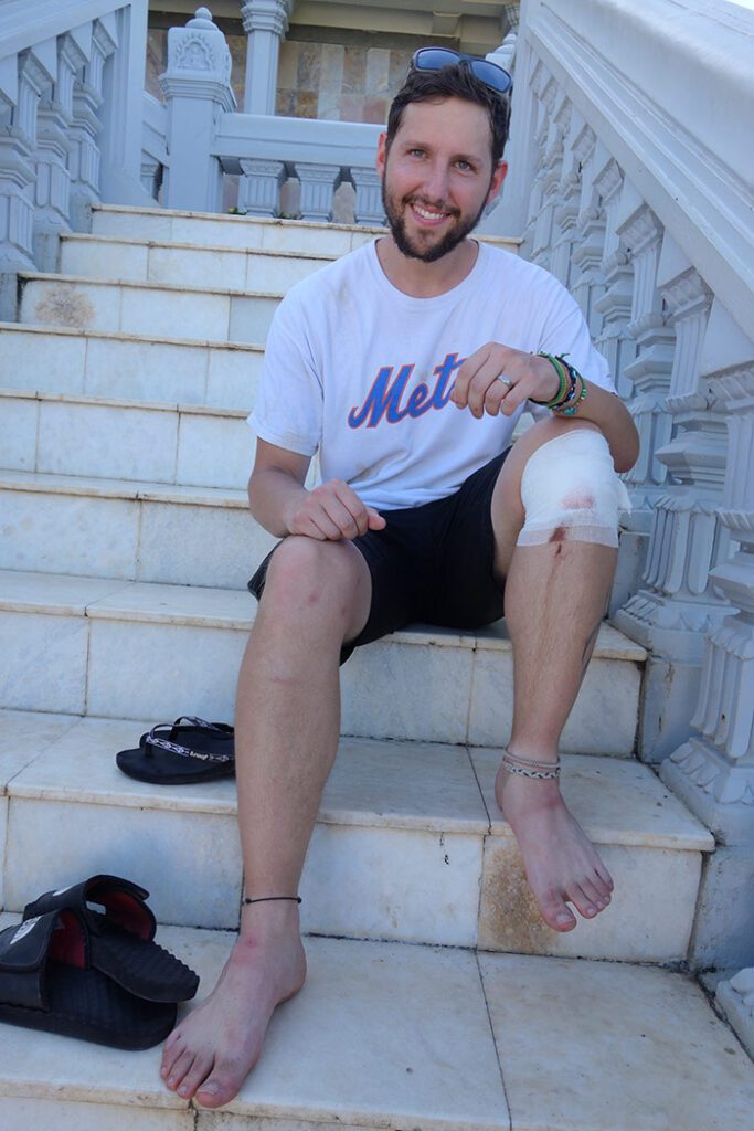 Shorty/ Paul Short sitting on the steps of a temple in Cambodia with blood running down his leg from a bandage on his knee after he fell of a scooter / motorcycle in Cambodia, Southeast Asia